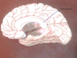 CUERPO CALLOSO
 