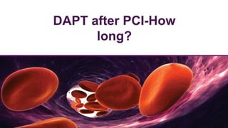DAPT after PCI-How
long?
 