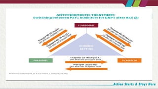 Dual Fast Plt String Dual anti platelet therapy- Comprehensive.pptx