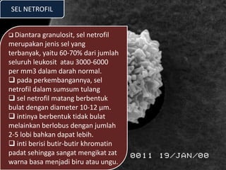 SEL NETROFIL
 Diantara granulosit, sel netrofil
merupakan jenis sel yang
terbanyak, yaitu 60-70% dari jumlah
seluruh leukosit atau 3000-6000
per mm3 dalam darah normal.
 pada perkembangannya, sel
netrofil dalam sumsum tulang
 sel netrofil matang berbentuk
bulat dengan diameter 10-12 µm.
 intinya berbentuk tidak bulat
melainkan berlobus dengan jumlah
2-5 lobi bahkan dapat lebih.
 inti berisi butir-butir khromatin
padat sehingga sangat mengikat zat
warna basa menjadi biru atau ungu.
 