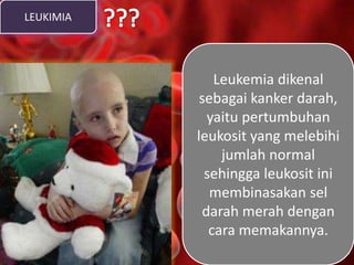 LEUKIMIA
Leukemia dikenal
sebagai kanker darah,
yaitu pertumbuhan
leukosit yang melebihi
jumlah normal
sehingga leukosit ini
membinasakan sel
darah merah dengan
cara memakannya.
 