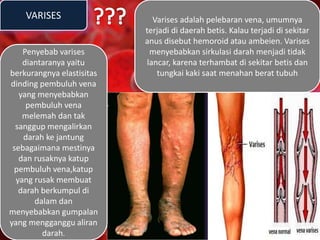 VARISES
Penyebab varises
diantaranya yaitu
berkurangnya elastisitas
dinding pembuluh vena
yang menyebabkan
pembuluh vena
melemah dan tak
sanggup mengalirkan
darah ke jantung
sebagaimana mestinya
dan rusaknya katup
pembuluh vena,katup
yang rusak membuat
darah berkumpul di
dalam dan
menyebabkan gumpalan
yang mengganggu aliran
darah.
Varises adalah pelebaran vena, umumnya
terjadi di daerah betis. Kalau terjadi di sekitar
anus disebut hemoroid atau ambeien. Varises
menyebabkan sirkulasi darah menjadi tidak
lancar, karena terhambat di sekitar betis dan
tungkai kaki saat menahan berat tubuh
 