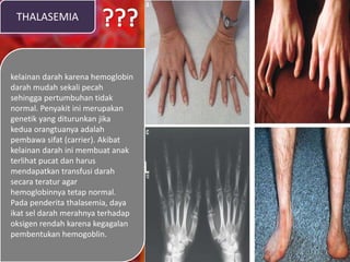THALASEMIA
kelainan darah karena hemoglobin
darah mudah sekali pecah
sehingga pertumbuhan tidak
normal. Penyakit ini merupakan
genetik yang diturunkan jika
kedua orangtuanya adalah
pembawa sifat (carrier). Akibat
kelainan darah ini membuat anak
terlihat pucat dan harus
mendapatkan transfusi darah
secara teratur agar
hemoglobinnya tetap normal.
Pada penderita thalasemia, daya
ikat sel darah merahnya terhadap
oksigen rendah karena kegagalan
pembentukan hemogoblin.
 
