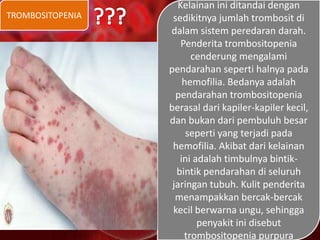 TROMBOSITOPENIA
Kelainan ini ditandai dengan
sedikitnya jumlah trombosit di
dalam sistem peredaran darah.
Penderita trombositopenia
cenderung mengalami
pendarahan seperti halnya pada
hemofilia. Bedanya adalah
pendarahan trombositopenia
berasal dari kapiler-kapiler kecil,
dan bukan dari pembuluh besar
seperti yang terjadi pada
hemofilia. Akibat dari kelainan
ini adalah timbulnya bintik-
bintik pendarahan di seluruh
jaringan tubuh. Kulit penderita
menampakkan bercak-bercak
kecil berwarna ungu, sehingga
penyakit ini disebut
trombositopenia purpura
 