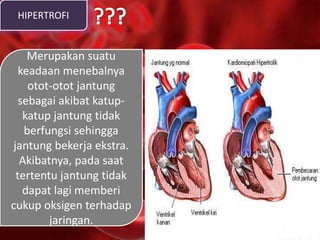 HIPERTROFI
Merupakan suatu
keadaan menebalnya
otot-otot jantung
sebagai akibat katup-
katup jantung tidak
berfungsi sehingga
jantung bekerja ekstra.
Akibatnya, pada saat
tertentu jantung tidak
dapat lagi memberi
cukup oksigen terhadap
jaringan.
 
