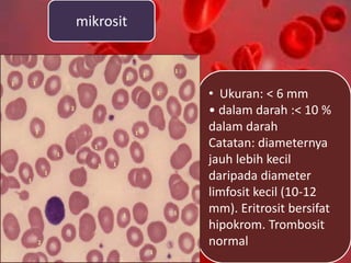 mikrosit
• Ukuran: < 6 mm
• dalam darah :< 10 %
dalam darah
Catatan: diameternya
jauh lebih kecil
daripada diameter
limfosit kecil (10-12
mm). Eritrosit bersifat
hipokrom. Trombosit
normal
 