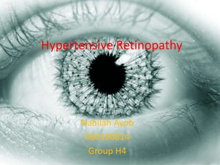 Hypertensive Retinopathy
Nabilah Ayob
060100814
Group H4
 
