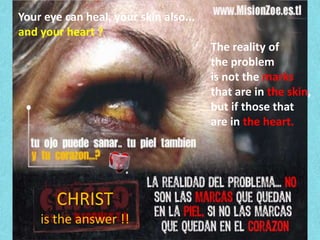 Your eye can heal, your skin also... and your heart ? The reality of the problem is not the marks that are in the skin , but if those that are in the heart. CHRIST is the answer !!
