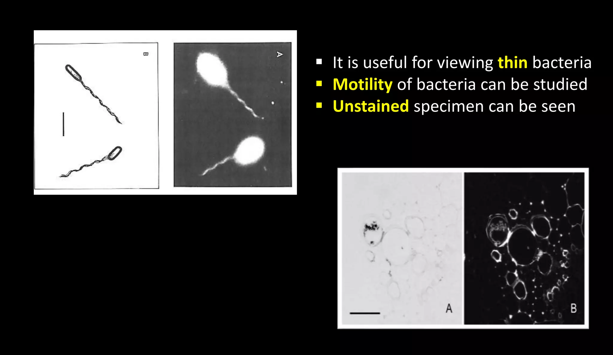 7
 It is useful for viewing thin bacteria
 Motility of bacteria can be studied
 Unstained specimen can be seen
 