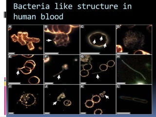 Bacteria like structure in
human blood
 