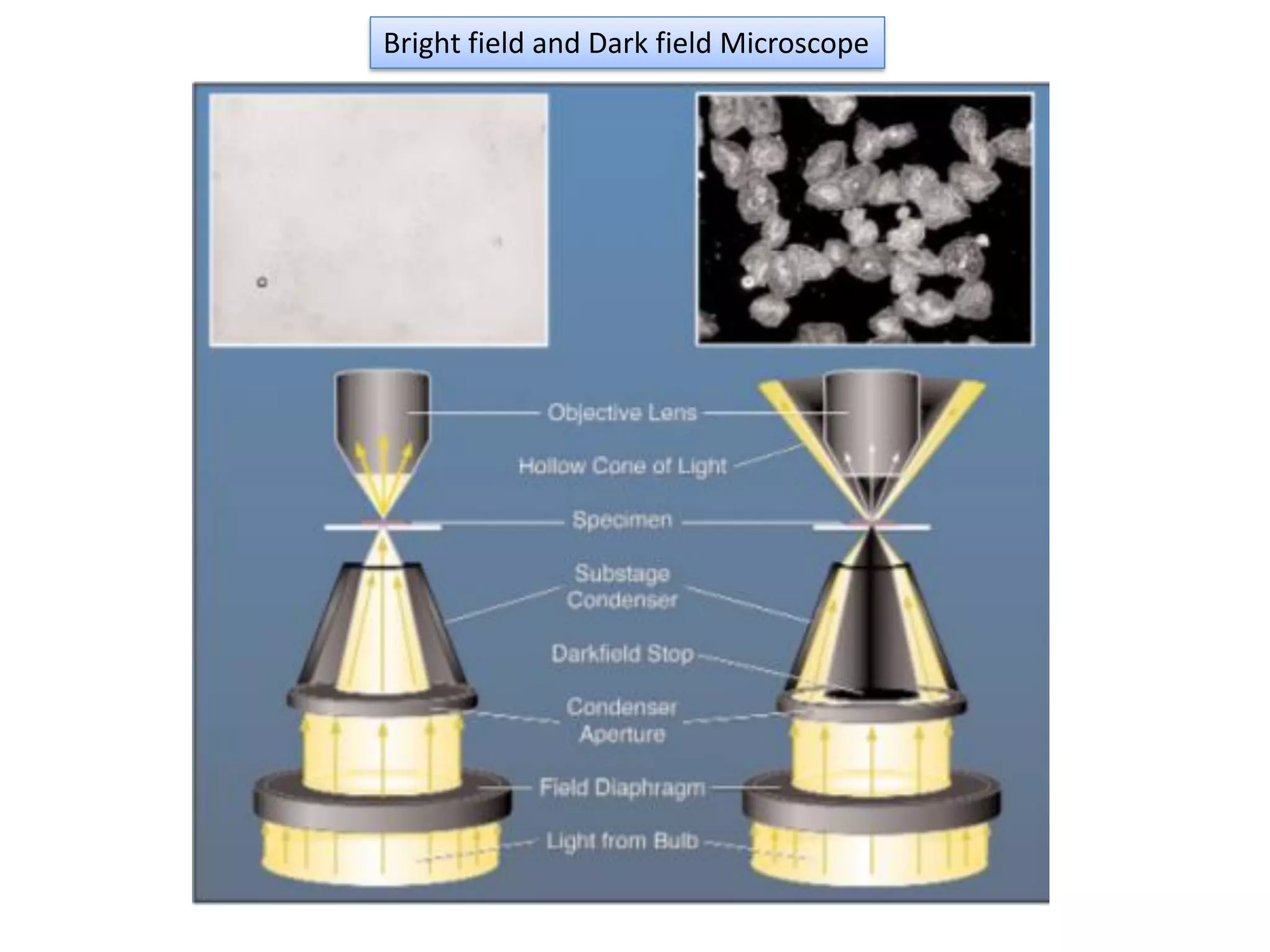 Bright field and Dark field Microscope
 