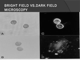 BRIGHT FIELD VS.DARK FIELD
MICROSCOPY
 