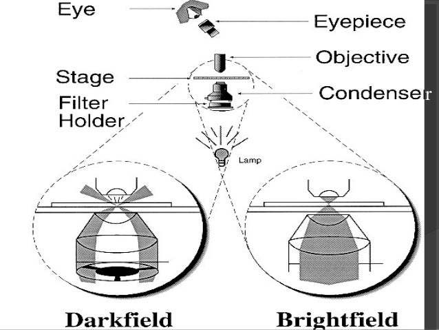 dark field microscopy
