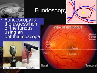 Dark room tests in ophthalmology | PPTX