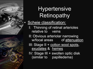 Scheie Classification System Dark room tests in ophthalmology | PPTX