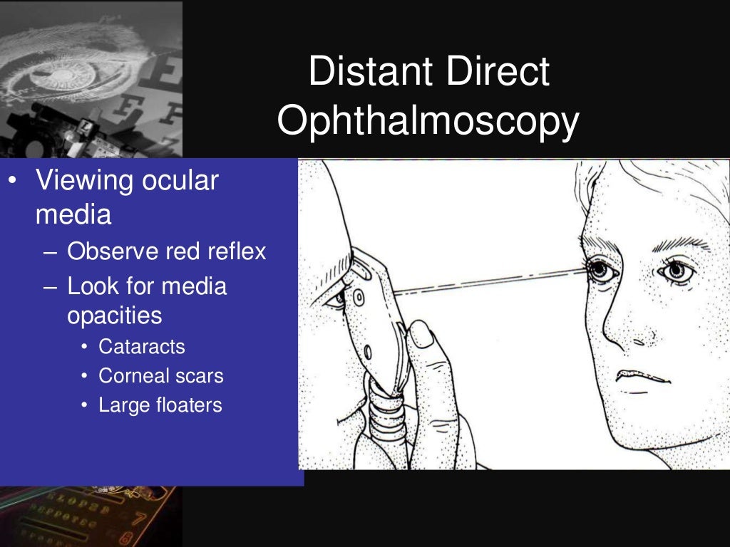 Dark room tests in ophthalmology