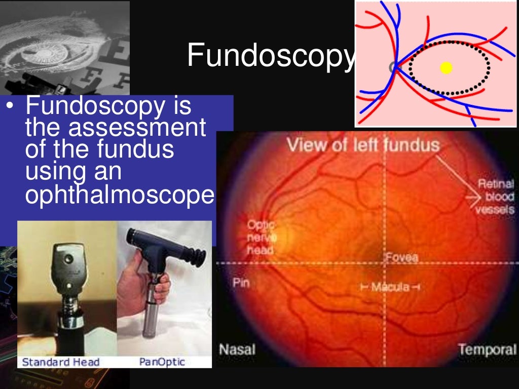 Dark room tests in ophthalmology