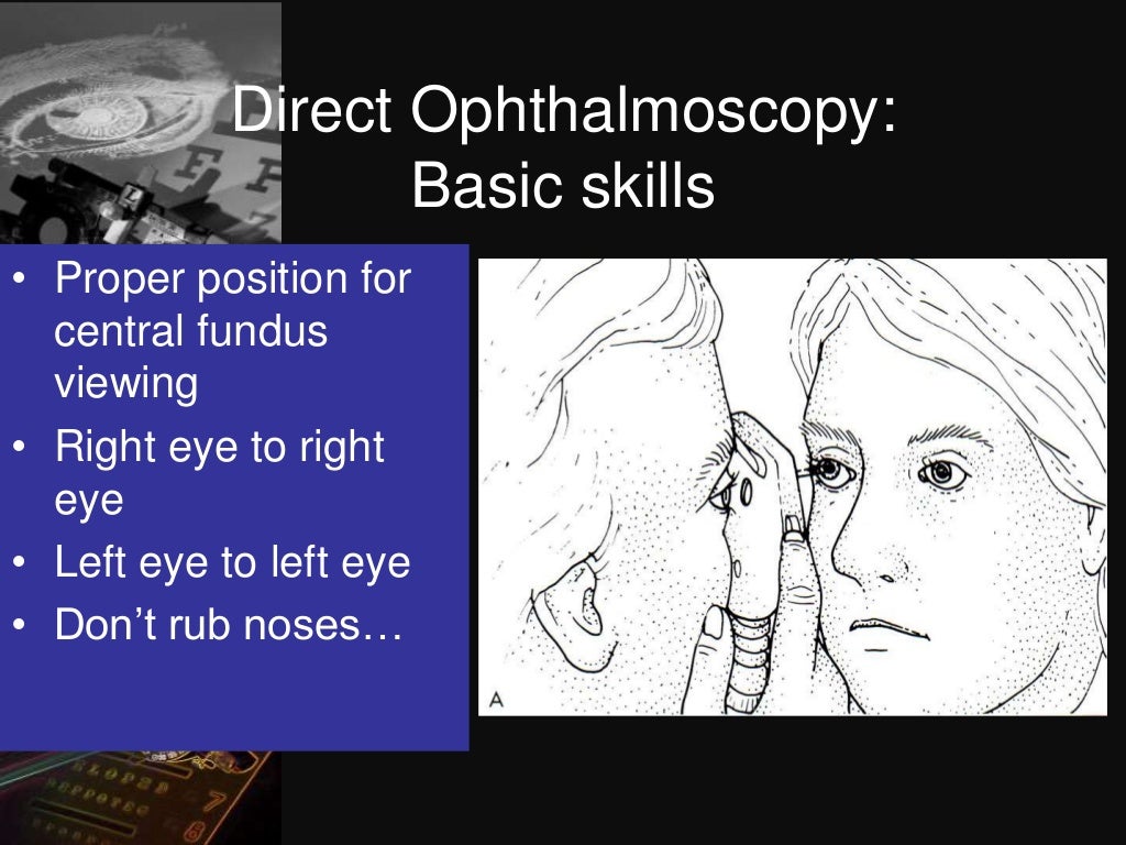 Dark room tests in ophthalmology