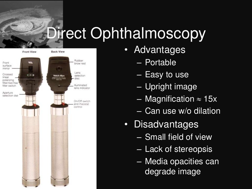Dark room tests in ophthalmology