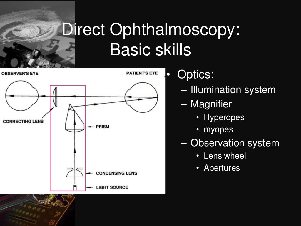 Dark room tests in ophthalmology