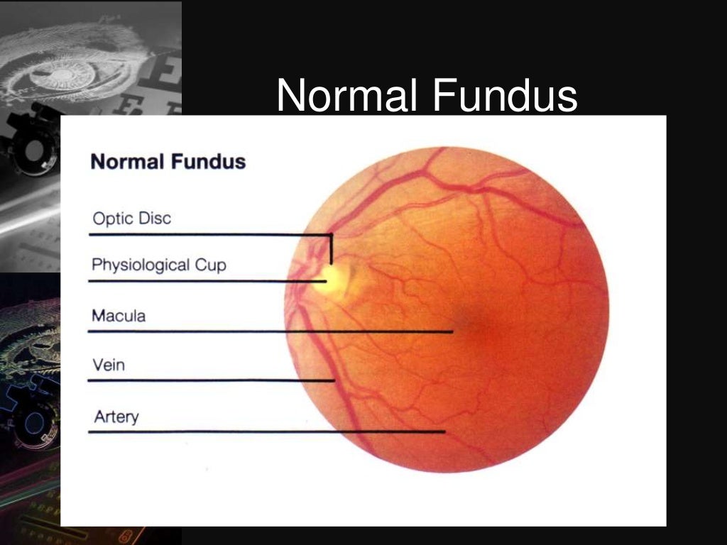Dark room tests in ophthalmology
