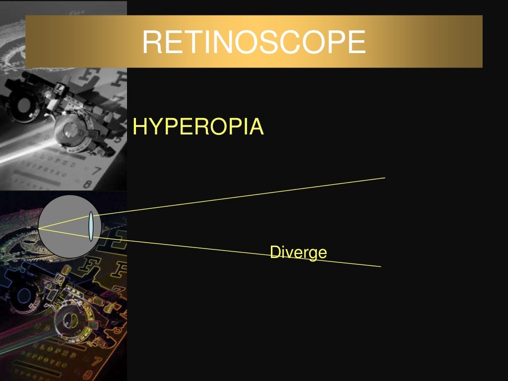 Dark room tests in ophthalmology