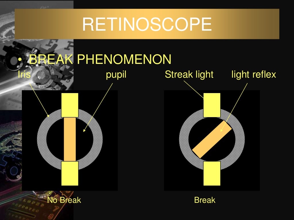 Dark room tests in ophthalmology