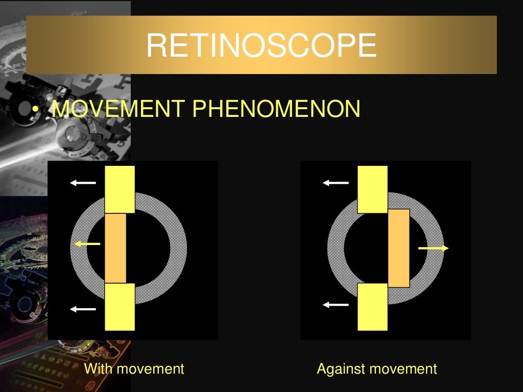Dark room tests in ophthalmology