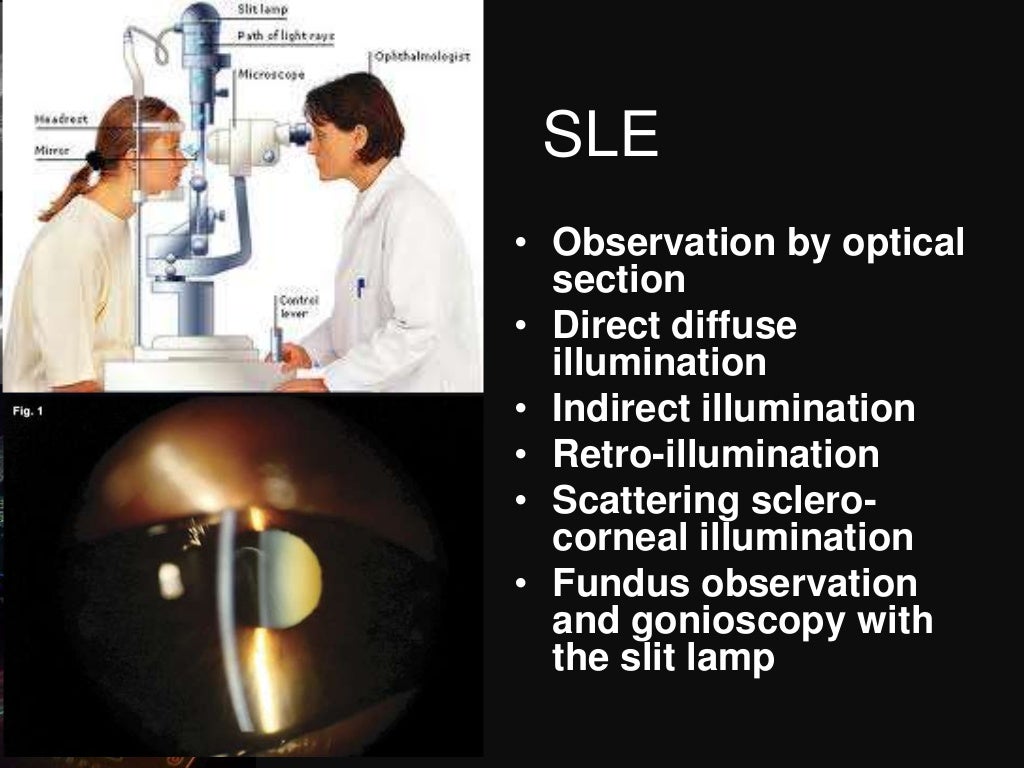 Dark room tests in ophthalmology