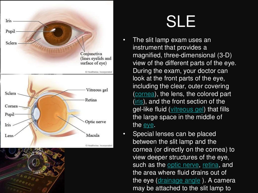 Dark room tests in ophthalmology