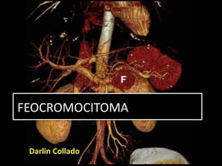 FEOCROMOCITOMA
Darlin Collado
 
