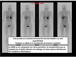 Esta prueba es la técnica funcional de elección debido a su alta
especificidad.
También es válida en la localización de tumores múltiples.
La MIBG es un compuesto con cierto parecido a la noradrenalina que es
captada por el tejido adrenal; sin embargo, no tiene apenas afinidad por
los receptores adrenérgicos.
 