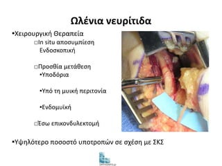 Ωλένια νευρίτιδα 
▪Χειρουργική Θεραπεία 
□In situ αποσυμπίεση 
Ενδοσκοπική 
□Προσθία μετάθεση 
▪Υποδόρια 
▪Υπό τη μυική περιτονία 
▪Ενδομυϊκή 
□Έσω επικονδυλεκτομή 
▪Υψηλότερο ποσοστό υποτροπών σε σχέση με ΣΚΣ 
 