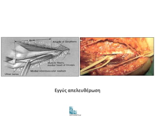 Εγγύς απελευθέρωση 
 