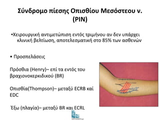 Σύνδρομο πίεσης Οπισθίου Μεσόστεου ν. 
(PIN) 
▪Χειρουργική αντιμετώπιση εντός τριμήνου αν δεν υπάρχει 
κλινική βελτίωση, αποτελεσματική στο 85% των ασθενών 
• Προσπελάσεις 
Πρόσθια (Henry)– επί τα εντός του 
βραχιονοκερκιδικού (BR) 
Οπισθία(Thompson)– μεταξύ ECRB καί 
EDC 
Έξω (πλαγία)– μεταξύ BR και ECRL 
 