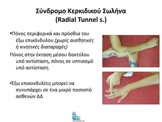 Σύνδρομο Κερκιδικού Σωλήνα 
(Radial Tunnel s.) 
▪Πόνος περιφερικά και πρόσθια του 
έξω επικόνδυλου (χωρίς αισθητικές 
ή κινητικές διαταραχές) 
Πόνος στην έκταση μέσου δακτύλου 
υπό αντίσταση, πόνος σε υπτιασμό 
υπό αντίσταση 
▪Έξω επικονδυλίτις μπορεί να 
συνυπάρχει σε ένα μικρό ποσοστό 
ασθενών ΔΔ 
 