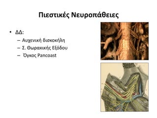Πιεστικές Νευροπάθειες 
• ΔΔ: 
– Αυχενική δισκοκήλη 
– Σ. Θωρακικής Εξόδου 
– Όγκος Pancoast 
 