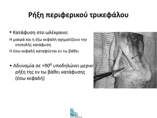 Ρήξη περιφερικού τρικεφάλου 
▪ Κατάφυση στο ωλέκρανο: 
Η μακρά και η έξω κεφαλή σχηματίζουν την 
επιπολής κατάφυση 
Η έσω κεφαλή καταφύεται εν τω βάθει 
• Αδυναμία σε >90⁰ υποδηλώνει μερική 
ρήξη της εν τω βάθει κατάφυσης 
(έσω κεφαλή) 
 