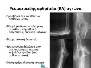 Ρευματοειδής αρθρίτιδα (RA) αγκώνα 
▪Προσβάλει έως το 50% των 
ασθενών με RA 
▪Φθορά χόνδρου, συνδεσμική 
αστάθεια, περιαθρική 
οστεοπενία, ρίκνωση θυλάκου 
▪Φαρμακευτική θεραπεία 
▪Βραχυχρόνια βελτίωση απο 
υμενεκτομή και εκτομή 
κεφαλής κερκίδας (και 
αρθροσκοπικά) 
▪Ολική αρθροπλαστική αγκώνα 
 