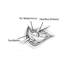Πρ. Βραχιονιος μ. Πρόσθιος θυλακος 
Τρικέφαλοςm. 
Posterior 
Capsule 
 