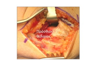 Πρόσθιος 
θύλακος 
 