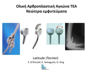 Ολική Αρθροπλαστική Αγκώνα TEA 
Νεώτερα εμφυτεύματα 
Latitude (Tornier) 
S. O’Driscoll, K. Yamaguchi, G. King 
 