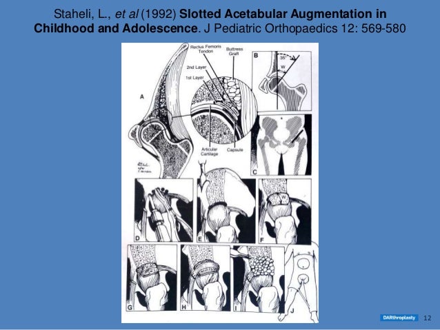 darthroplasty-practical-training-wet-labs-part-2-13-638.jpg