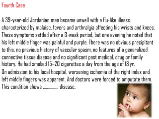 Fourth Case

A 39‐year‐old Jordanian man became unwell with a flu‐like illness
characterized by malaise, fevers and arthralgia affecting his wrists and knees.
These symptoms settled after a 3‐week period, but one evening he noted that
his left middle finger was painful and purple. There was no obvious precipitant
to this, no previous history of vascular spasm, no features of a generalized
connective tissue disease and no significant past medical, drug or family
history. He had smoked 15–20 cigarettes a day from the age of 18 yr.
On admission to his local hospital, worsening ischemia of the right index and
left middle fingers was apparent. And doctors were forced to amputate them.
This condition shows …………… disease.
 