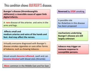 This condition shows BUERGER’S disease.
Buerger's disease (thromboangiitis                Reversed by STOP smoking
obliterans): a reversible cause of upper limb
digital infarcts.
                                                  A possible role
A rare disease of the arteries and veins in the   for Rickettsia in this disease
arms and legs.                                    has been proposed

 Affects small and
                                                  mechanisms underlying
medium arteries and veins of the hands and
                                                  Buerger's disease are still
feet. And may affect the nerves.
                                                  largely unknown

Virtually everyone diagnosed with Buerger's
disease smokes cigarettes or uses other forms     tobacco may trigger an
of tobacco, such as chewing tobacco.              immune response in
                                                  susceptible persons.
blood vessels become inflamed, swell and can
become blocked with blood clots (thrombi)

More common in the Middle East and Far East
 