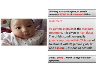 Coronary artery aneurysms, or ectasia,
develop in 15%–25% of untreated children.

Treatment

I.V gamma globulin is the standard
treatment. It is given in high doses.
The child's condition usually
greatly improves within 24 hours of
treatment with IV gamma globulin.
And aspirin…..as soon as possible.

Dose: 2 gm/kg . within 10 days of onset of
symptoms.
 