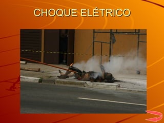 CHOQUE ELÉTRICO 