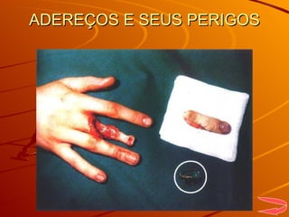 ADEREÇOS E SEUS PERIGOS 