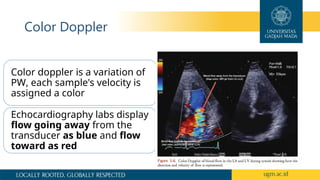 dasar dasar echocardiography dan aplikasi | PPTX