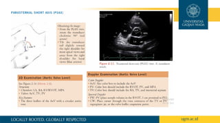 dasar dasar echocardiography dan aplikasi | PPTX